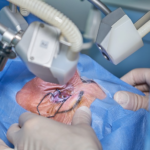 lasik eye surgery in pune
